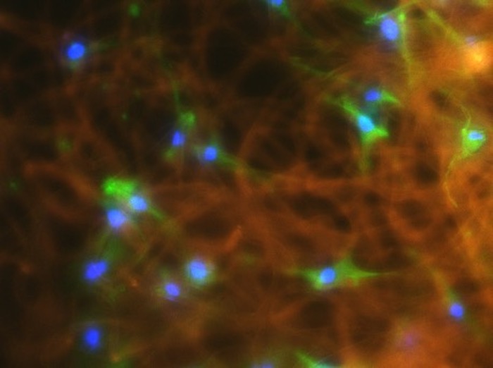 Human mesenchymal stromal cells on fibers