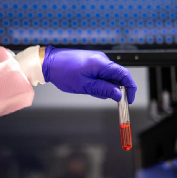 a gloved hand holding a vial with a red liquid in it